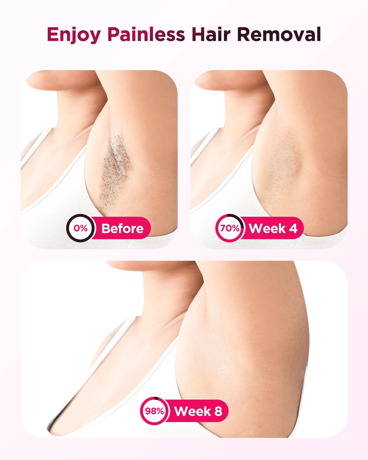 LumenVitta™ Laser Hair Removal at Home Pro